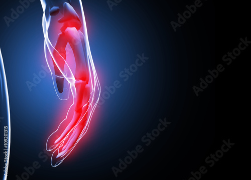Fototapeta Naklejka Na Ścianę i Meble -  3d render Human hand and wrist pain caused by arthritis and carpal tunnel syndrome injury in the hand joint as an anatomy with skeleton and highlighted injured body part as a medical and health care.
