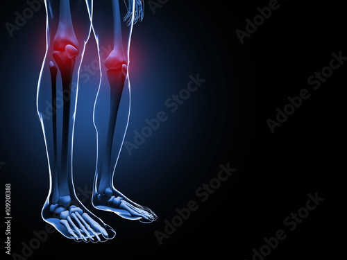3d illustration Knee Pain Skeleton