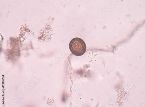 Egg parasite in stool exam real sample. photo