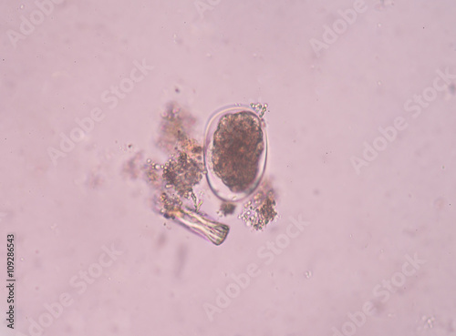 Egg parasite in stool exam real sample. photo