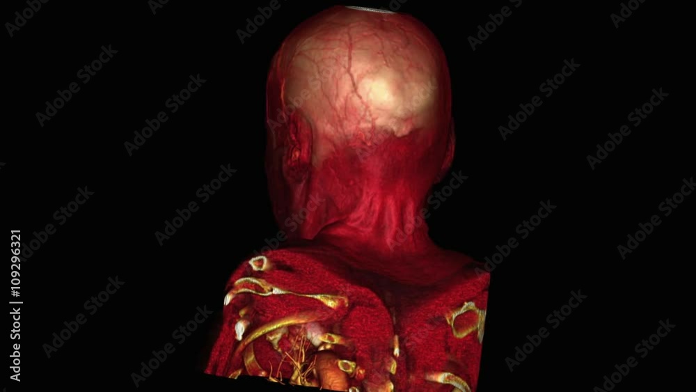 Human skull