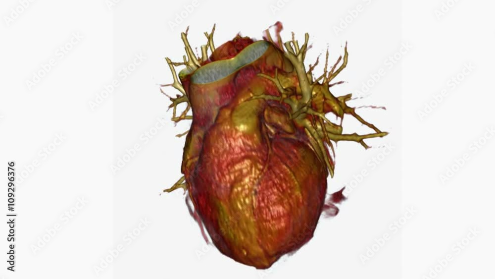 Human heart