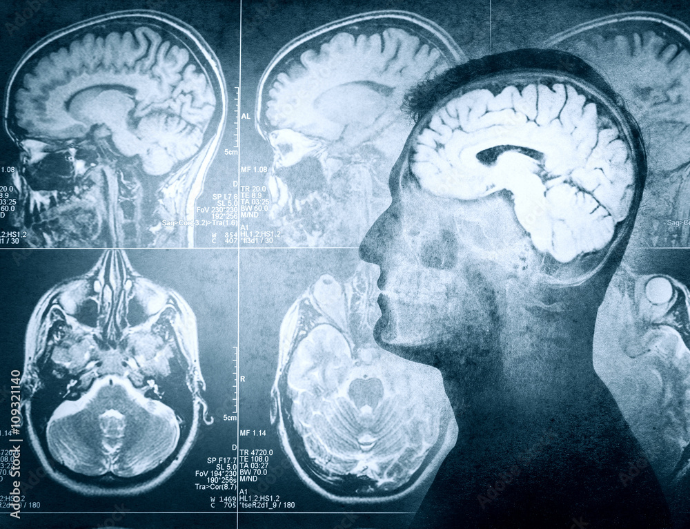 Conceptual image of a man from side profile showing brain and brain