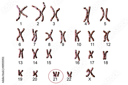 Down-syndrome karyotype, female, labeled, isolated on white background. Trisomy 21. 3D illustration