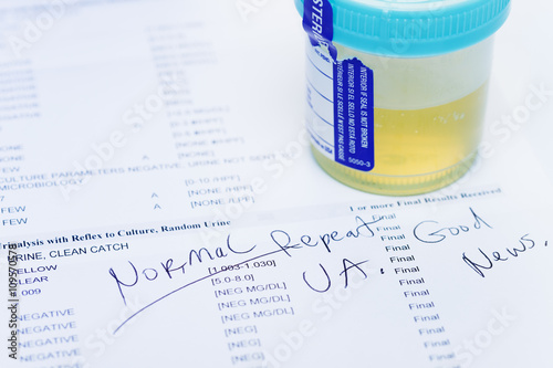Studio shot of urine sample on test printout showing normal results. Testing is done as part of yearly health checkup photo