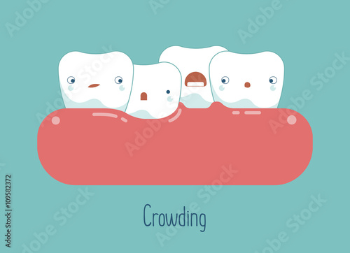 Crowding teeth ,dental concept