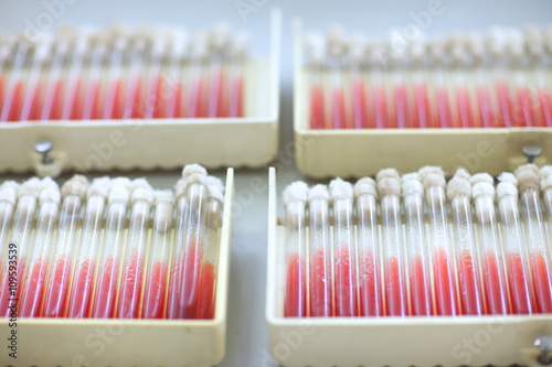 Plates with sterile culture tubes