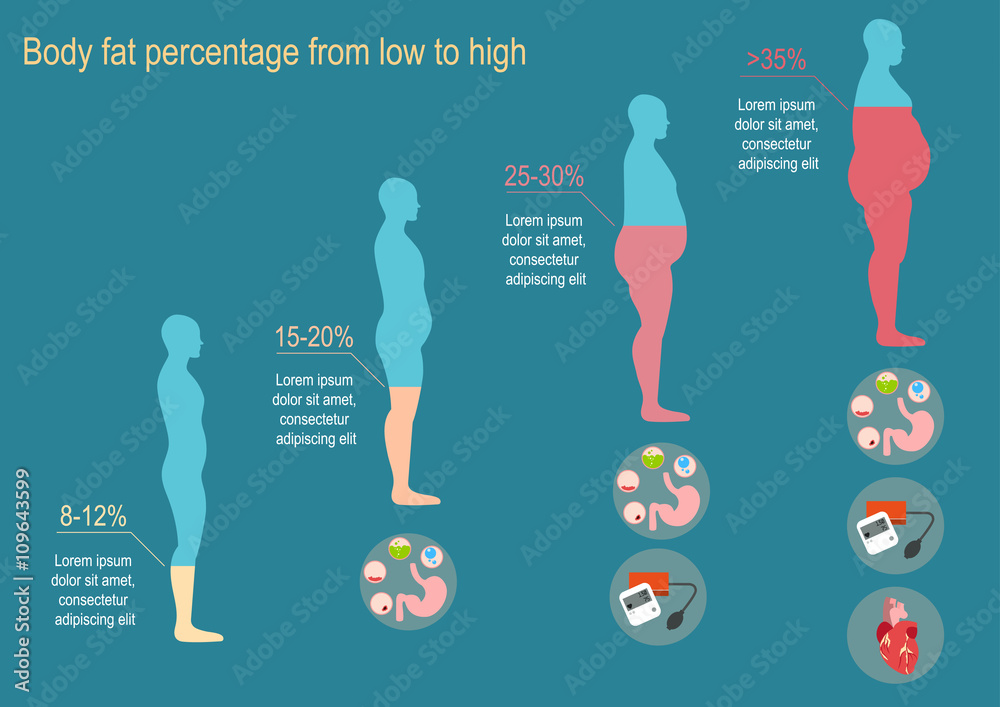The degree of obesity. Vector illustration. The progression of obesity