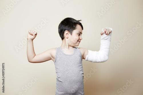 cute boy with broken arm