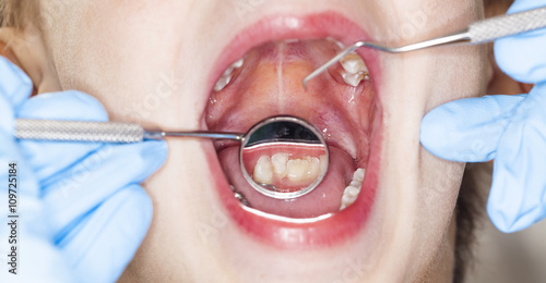 inspection of the oral kid cavity dental dentist