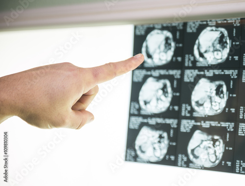 Medical experts studied the EEG condition of the patient