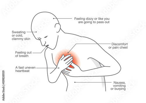 Symptoms of heart attack disease. Medical illustration.