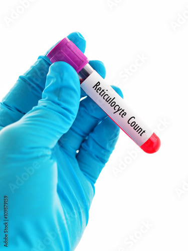 Blood sample for reticulocyte count, immature red blood cell analysis
 photo