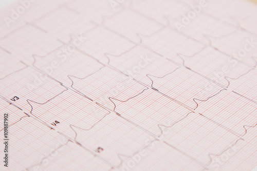 Medical report and cardiogram