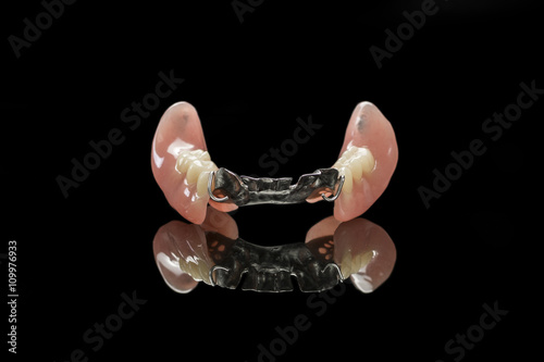 Removable partial denture