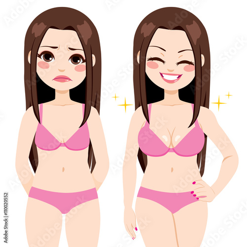 Woman before and after breast augmentation plastic surgery