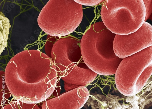 Blood clot, SEM
