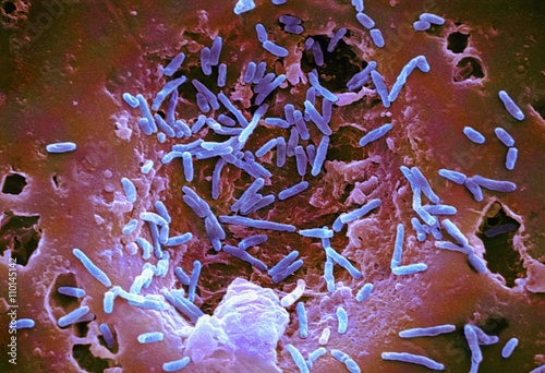 Mycobacterium chelonae bacteria, SEM photo