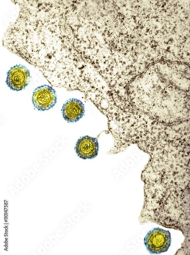 Herpes virus particles, TEM photo