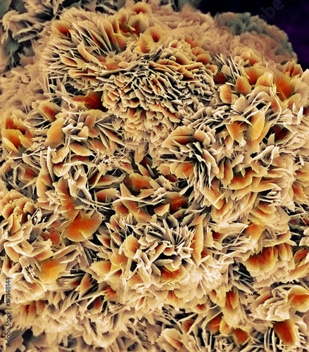 Kidney stone crystals, SEM