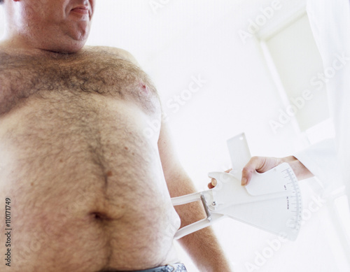 Body fat assessment photo