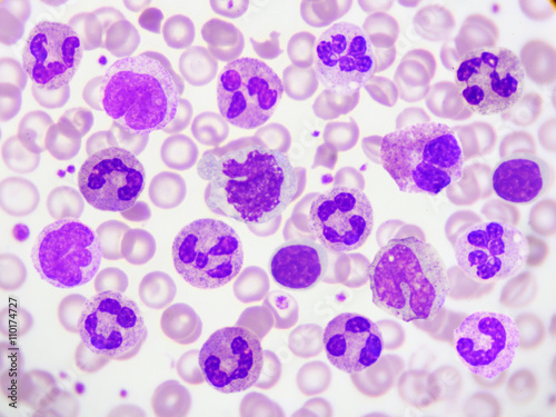 White blood cells in peripheral blood smear, Wright stain photo