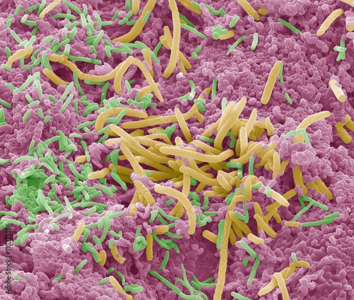 Tongue bacteria, SEM photo