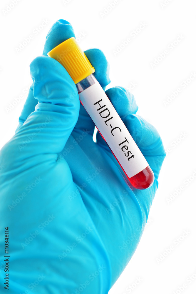 Obraz premium Blood sample for HDL-C (high density lipoprotein cholesterol) test 