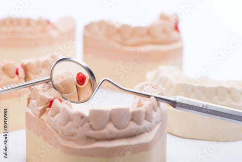 Teeth molds with basic dental tools on a bright white table photo