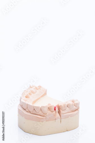 Teeth mold on a bright white table