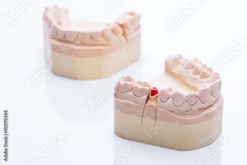 Teeth molds on a bright white table