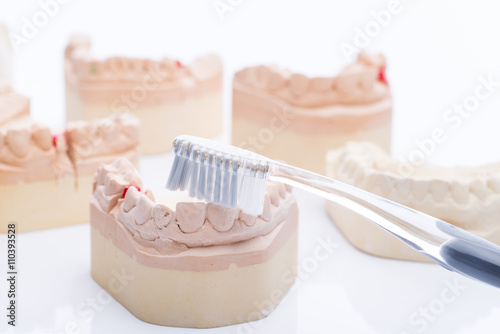 Teeth molds with toothbrush on a bright white table