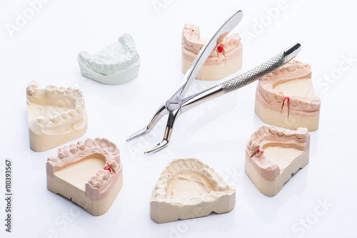 Teeth molds with basic dental tools on a bright white table