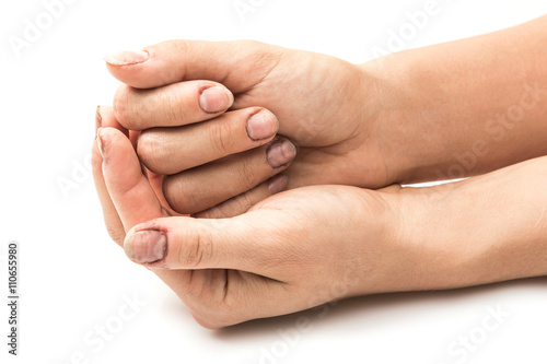 Slika na platnu Female hands with dirty nails