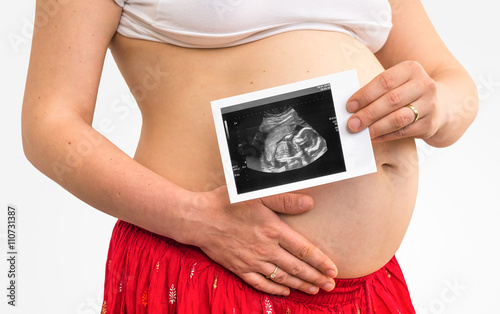 Belly of a pregnant woman and ultrasound with baby photo