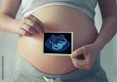 Pregnant woman with ultrasound scan photo