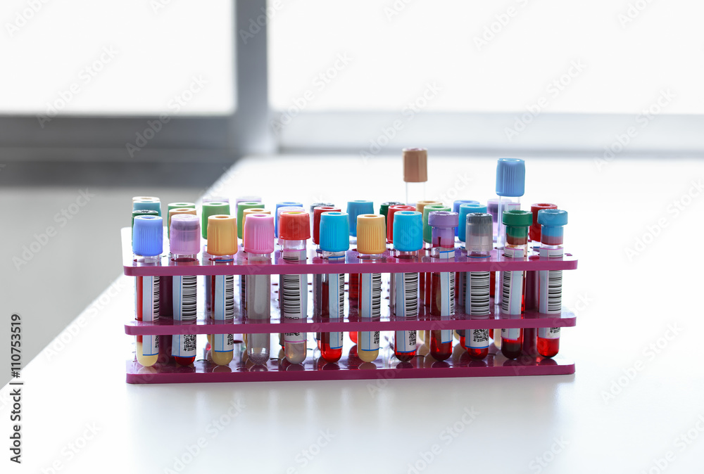 Foto de Rack with blood samples in tubes in the lab / blood tubes