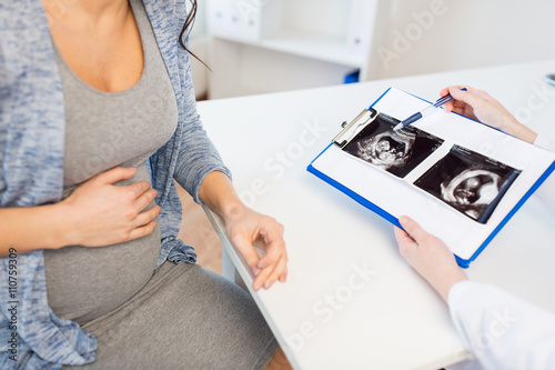 close up of doctor and pregnant woman ultrasound photo