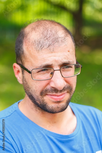 portrait of young man with bad eyesight and hair loss.