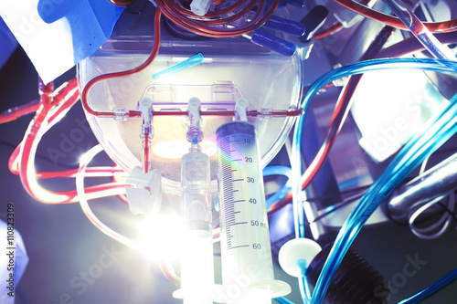 Medical equipment with tubes of blood and solutions