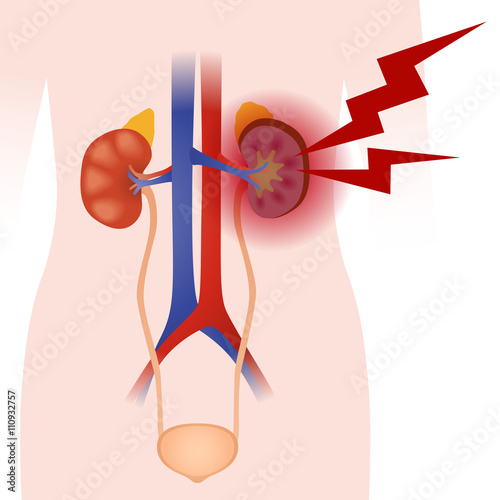 Inflammation of the kidney, human urinary organs, heart, kidney, bladder, vector illustration