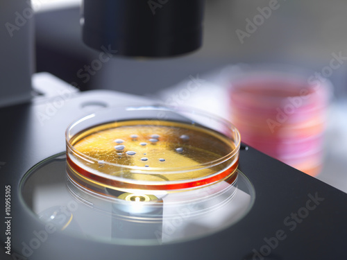 Petri dish containing bacterial culture being examined with inverted light microscope in microbiology lab photo