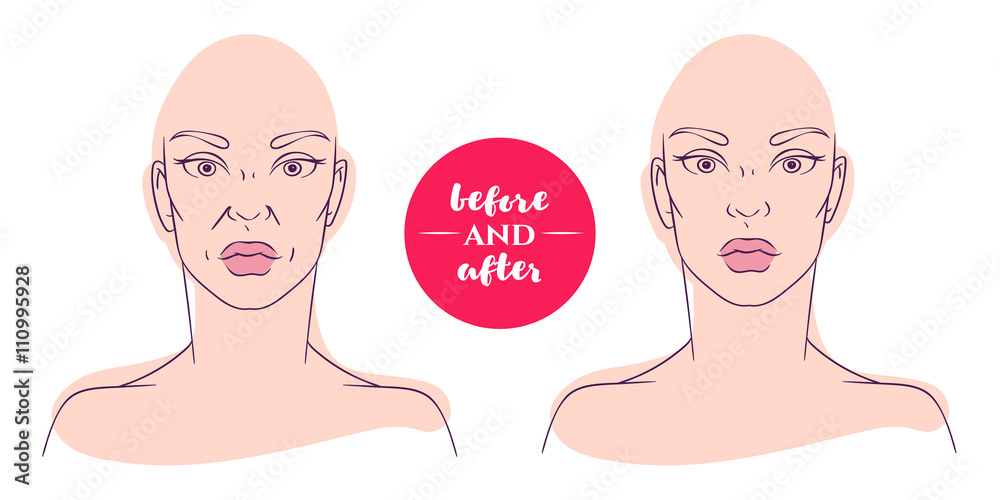 Portrait of a woman before and after with cosmetic defects. Portrait of a woman before and after with cosmetic defects.