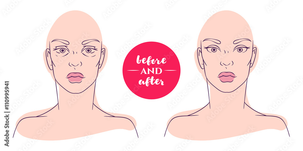 Portrait of a woman before and after with cosmetic defects. Portrait of a woman before and after with cosmetic defects.