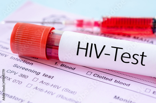 HIV test label on HIV infection screening test form.