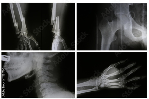 collection of film x-ray