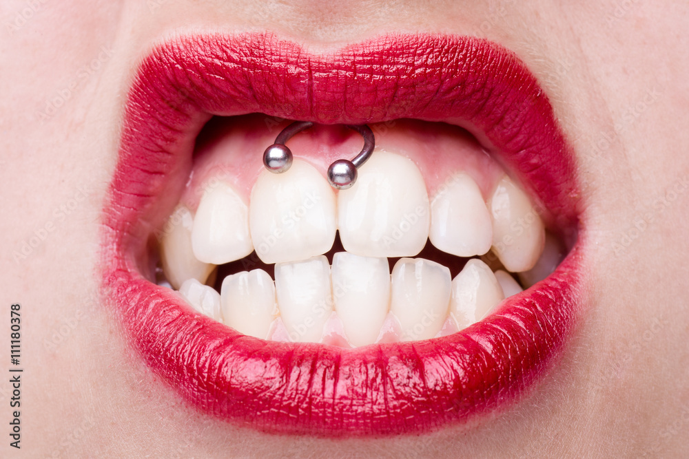 Fototapeta premium Smiley Piercing Detail with Snarling Woman's Mouth