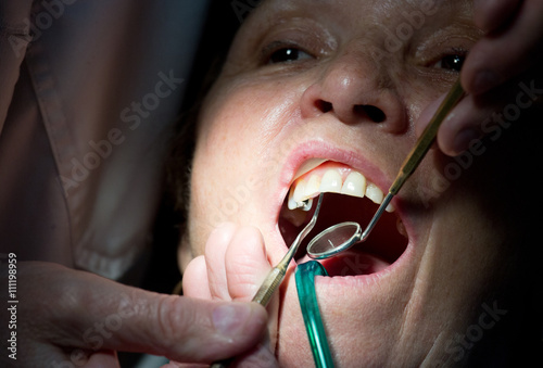 Dentist working on teeth photo