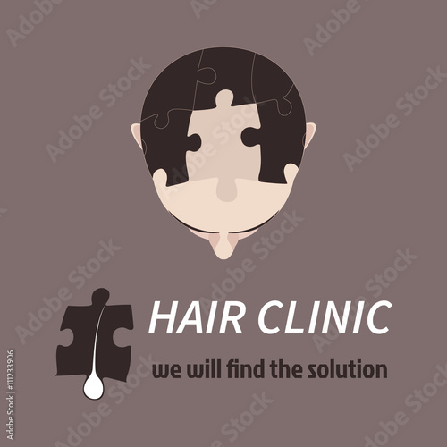 Top view portrait of a man with hair puzzle elements. Jigsaw puzzle solution. Solving hair loss problem concept. Perfect design for a hair clinic or diagnostic centre. Isolated vector illustration.