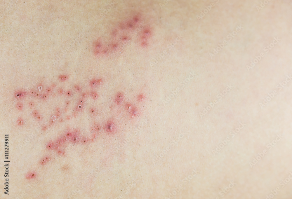Red bumps on skin deals